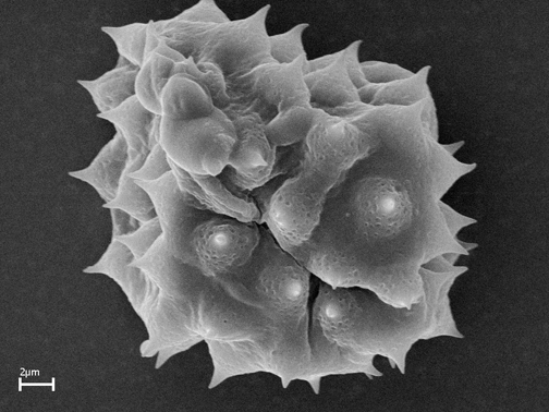 Scanning electron microscope image of pollen grain. Dimorphotheca (Osteospermum) ecklonis.